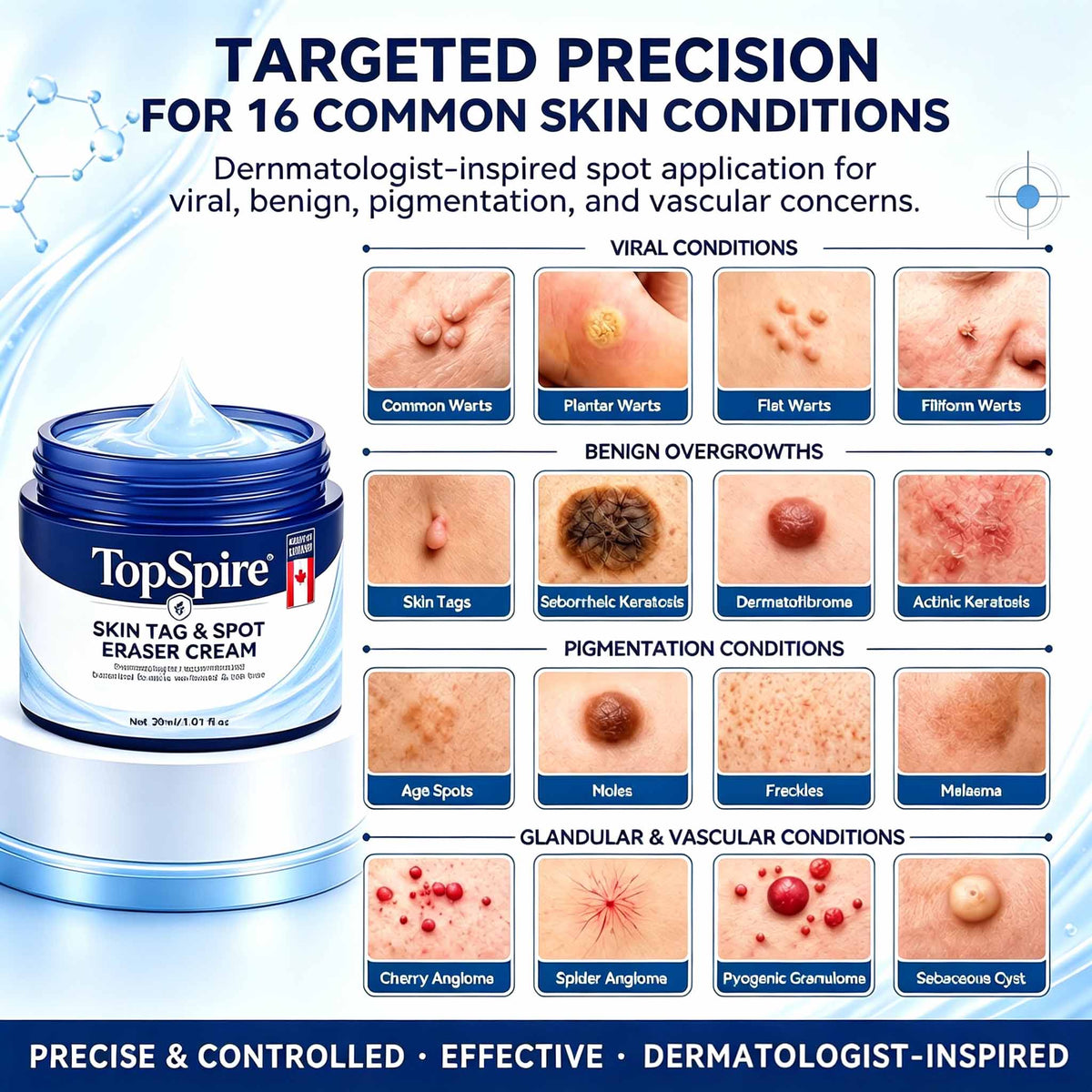 TopSpire® 7-𝐃𝐚𝐲 𝐒𝐤𝐢𝐧 𝐓𝐚𝐠 & 𝐒𝐩𝐨𝐭 𝐄𝐫𝐚𝐬𝐞𝐫 𝐂𝐫𝐞𝐚𝐦 (Zero Pain, Zero 𝐒𝐜𝐚𝐫𝐬 Formula)🌱