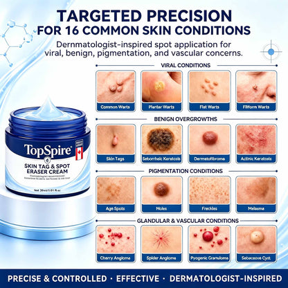 TopSpire® 7-𝐃𝐚𝐲 𝐒𝐤𝐢𝐧 𝐓𝐚𝐠 & 𝐒𝐩𝐨𝐭 𝐄𝐫𝐚𝐬𝐞𝐫 𝐂𝐫𝐞𝐚𝐦 (Zero Pain, Zero 𝐒𝐜𝐚𝐫𝐬 Formula)🌱
